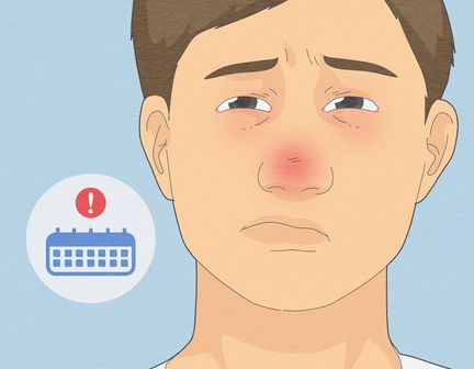 Cara Hilangkan Hidung Tersumbat